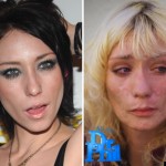 Faces of Meth