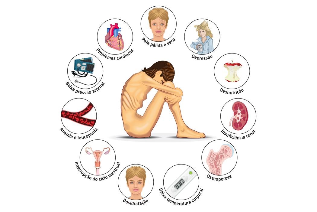 image showing the effects and symptoms of anorexia taken from a a portuguese source