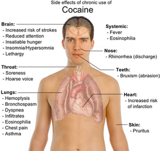 Image showing the cocaine effects on the body