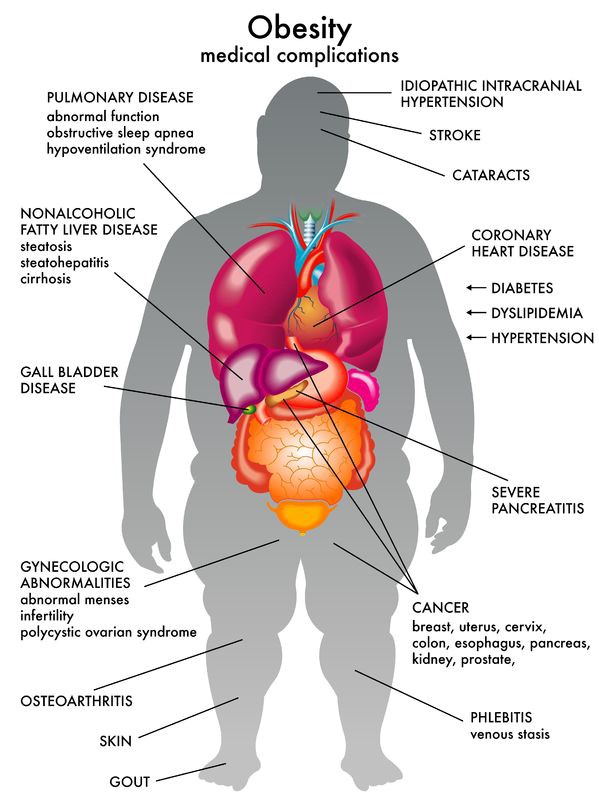 male obesity chart