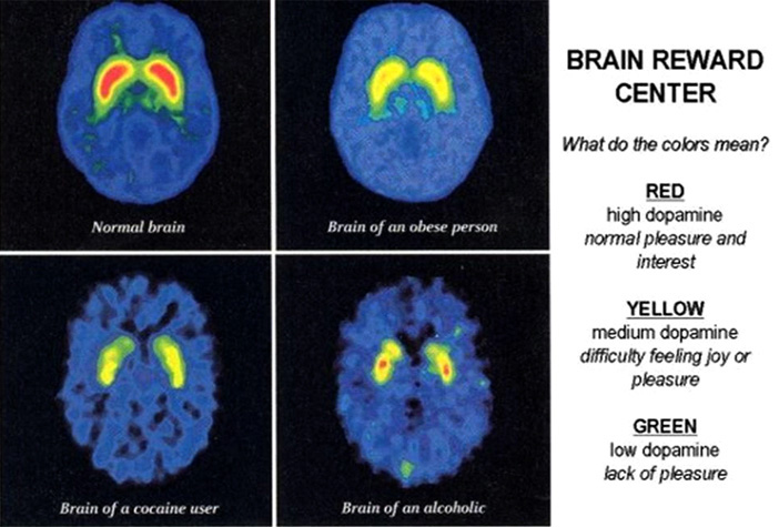 image showing the brain reward centres