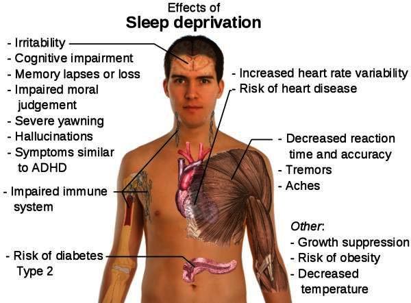 effects of sleep deprivation image