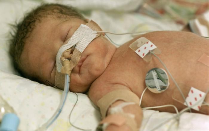 image of a a baby being treated in the hospital