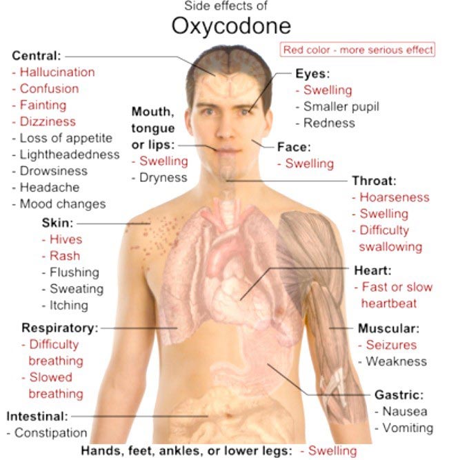 side-effects of oxycodone